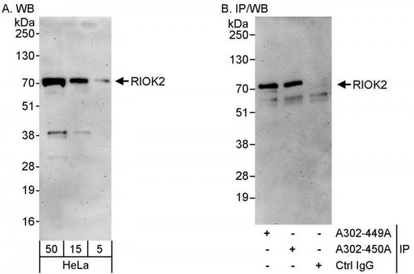 Anti-RIOK2