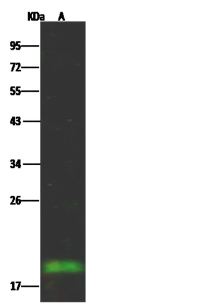 Anti-Fragile histidine triad/FHIT Monoclonal Recombinant Antibody