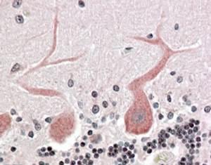 Anti-Cdc42-binding kinase alpha, N-terminal