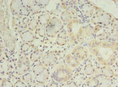 Anti-PRRC1