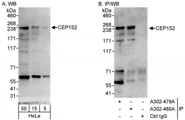 Anti-CEP152