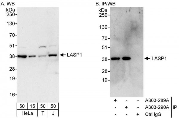 Anti-LASP1