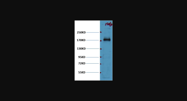 Anti-EGFR, monoclonal