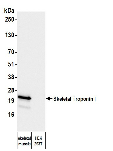 Anti-Skeletal Troponin I Monoclonal