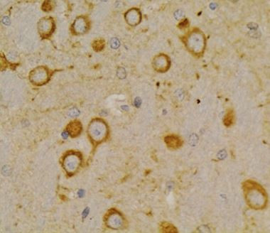 Anti-TSHR / TSH Receptor