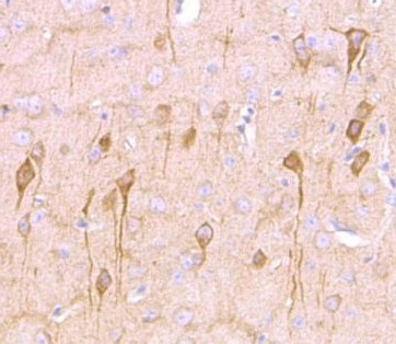 Anti-NG2 / Chondroitin sulfate proteoglycan 4