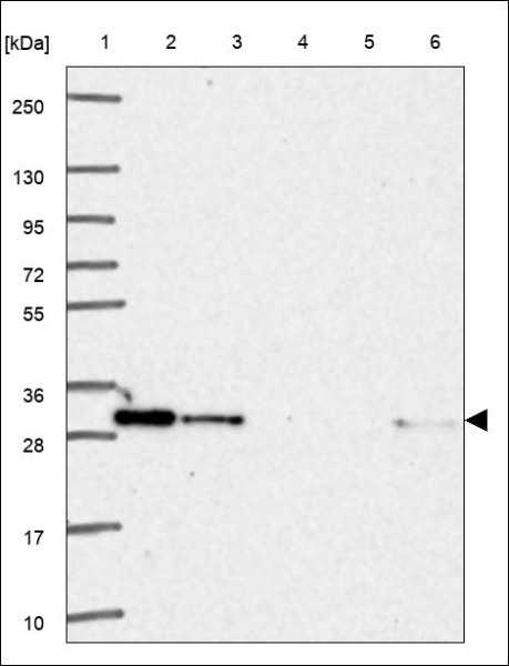 Anti-PAFAH1B2