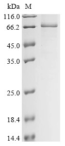 Insulin-like growth factor 2 mRNA-binding protein 1 (IGF2BP1), human, recombinant
