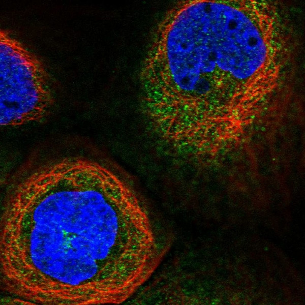 Anti-DCTN2