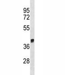 Anti-Arg1