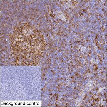 Anti-HLA-DRA
