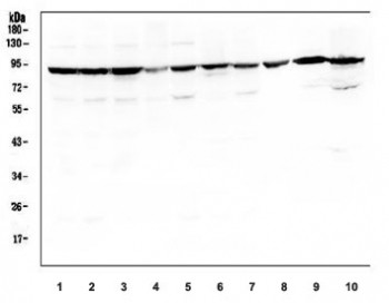 Anti-SERT / Serotonin Transporter / SLC6A4