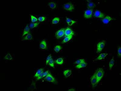 Anti-CD14