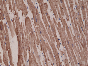 Anti-Alpha Cardiac Actin, Rabbit Monoclonal (RM257)