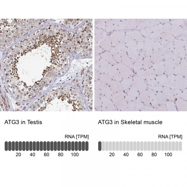 Anti-ATG3