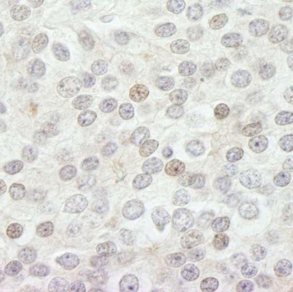 Anti-JARID1B (IHC)