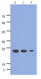 Anti-ADI1, clone 27E8