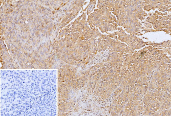 Anti-Glypican 3 / GPC3, clone GPC3/12698
