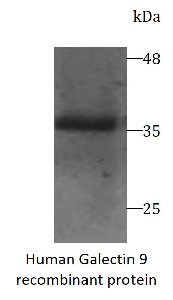 Human Galectin 9 recombinant protein (Active) (His-tagged)