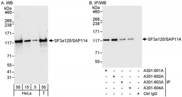 Anti-SF3a120/SAP114