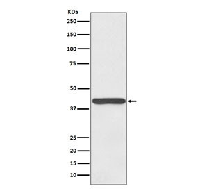 Anti-Haptoglobin, clone AACE-8