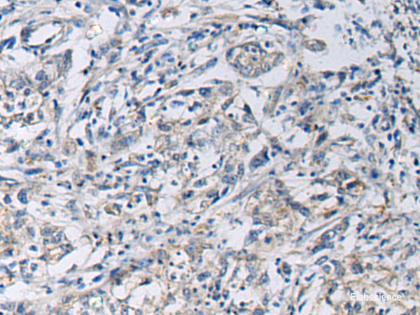 Anti-KCNJ10