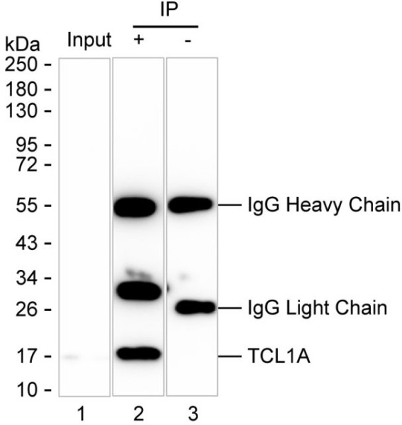 Anti-T Cell Leukemia/Lymphoma Protein 1A