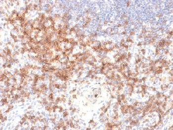 Anti-CD27 (Tumor Necrosis Factor Receptor Superfamily 7) Recombinant Rabbit Monoclonal Antibody (clo