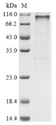 2-5A-dependent ribonuclease (RNASEL), human, recombinant