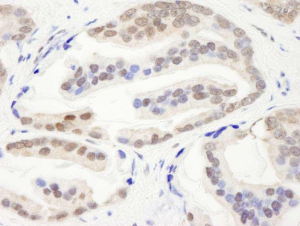 Anti-CHD3 (IHC)