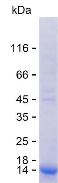 Recombinant Human CIB3 Protein