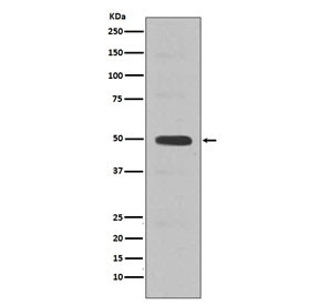 Anti-Cyclin E2 / CCNE2, clone EDB-3