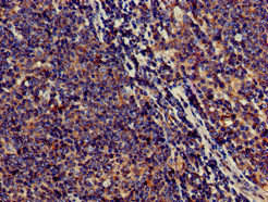 Anti-SAMD8