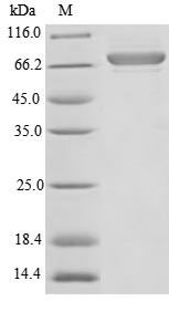 Plasma alpha-L-fucosidase (FUCA2), partial, human, recombinant