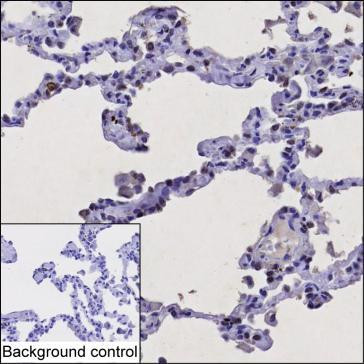 Anti-Thyroid Transcription Factor 1