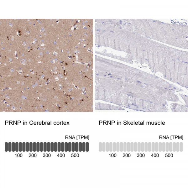 Anti-PRNP