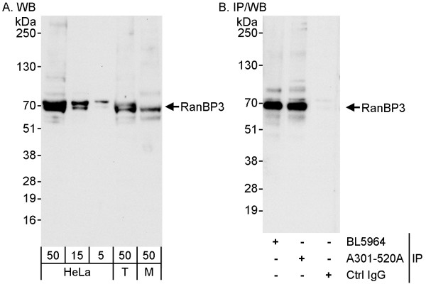 Anti-RanBP3