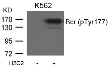 Anti-phospho-Bcr (Tyr177)