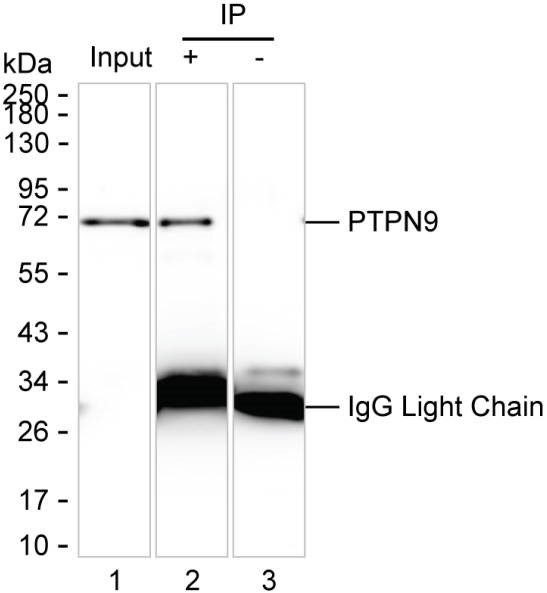 Anti-PTPN9