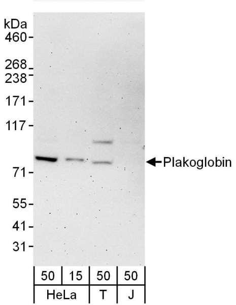 Anti-Plakoglobin