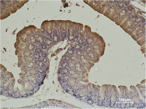 Anti-ACTA2 Monoclonal