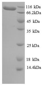 Elongation factor 2 (EEF2), human, recombinant