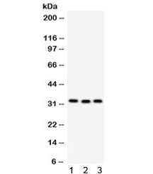 Anti-C1QBP / GC1q R