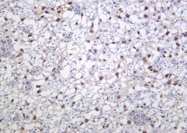 Anti-Recombinant PPAR-gamma, clone 11A10