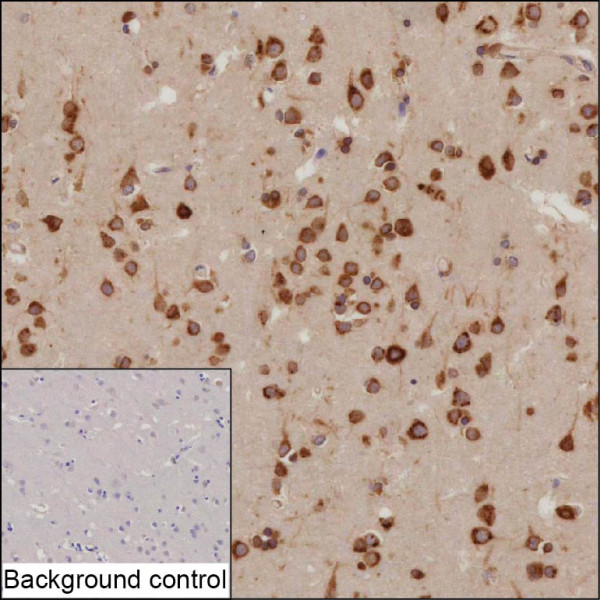 Anti-NUCB1