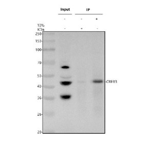 Anti-CREB3 / Cyclic AMP-responsive element-binding protein 3