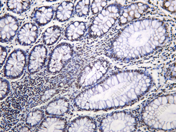 Anti-Recombinant NF90, clone C112551