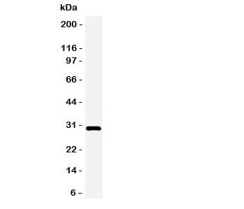 Anti-Adiponectin