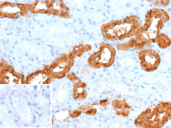 Anti-Calbindin-1 / CALB1 (Neuronal Marker), recombinant antibody, clone rKR6