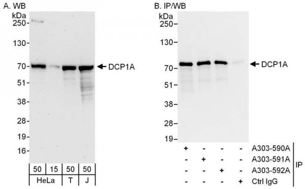 Anti-DCP1A